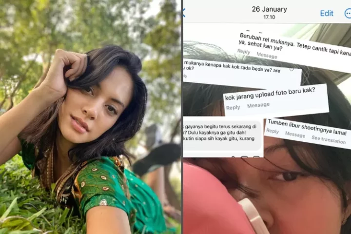 Aurelie Moeremans terkena tumor colli, tiba-tiba gak bisa senyum