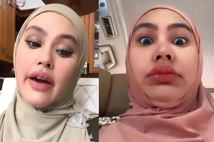 Duh! Disinggung soal dandanan menor, Kartika Putri malah buka-bukaan soal bulu tubuhnya ini: Lebat banget