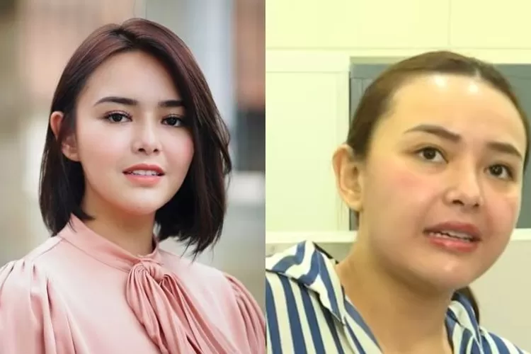 Amanda Manopo habiskan 100 juta untuk perawatan, netizen justru salfok ke penampilannya sekarang: Kayak udah..