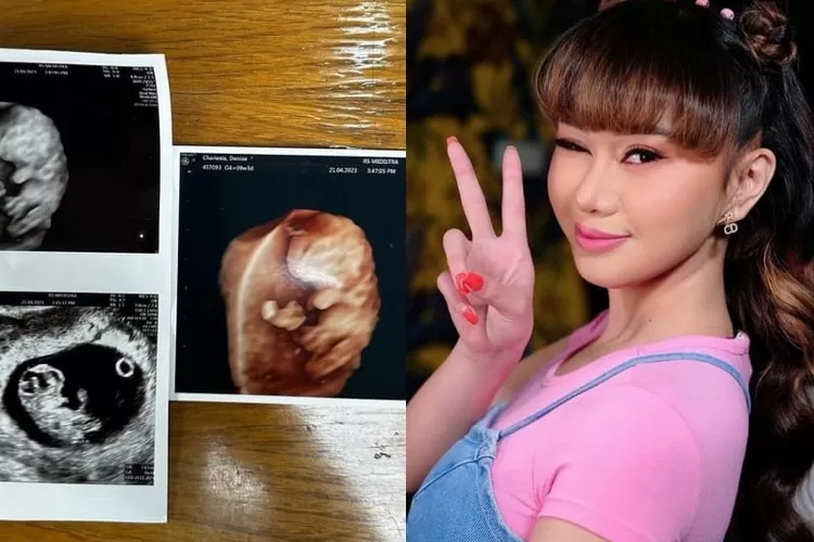 Ditanya kenapa tidak nikah dulu sebelum buat anak, Denise Chariesta nyengir tanpa dosa: Udah dikasih Tuhan...