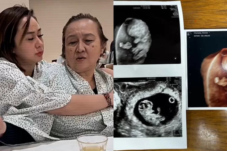 Memilih nerima apa yang sudah terjadi pada putrinya, ibu Denise Chariesta harapkan ini ke Baby DC: Biar sehat