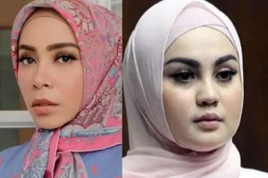 Berkaca sukses artis turunkan BB puluhan kilogram lewat operasi bariatrik, ternyata ada risikonya