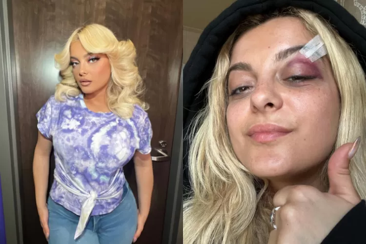 Pelaku akhirnya tertangkap usai lempar ponsel ke Bebe Rexha di konser, penyanyi unggah foto jahitan mata lebam