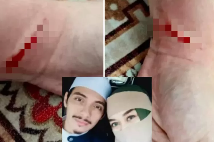 Nyaris tewas dan gila, ngilunya Zeda Salim bercerita detail siksaan Habib Ali Jindan: Dihantam berkali-kali..