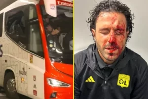 Mantan pemain Timnas Italia, Fabio Grosso alami insiden di bus saat bertandang ke kandang Olympique Marseille