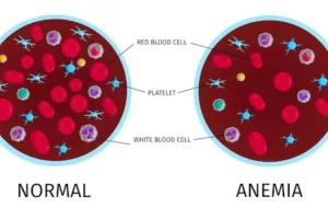 Ini dia alasan mengapa kamu jangan sampai mengalami anemia, berikut cara mencegahnya